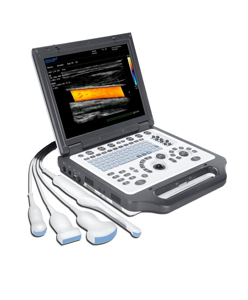 EMPEROR G30 COLOR DOPPLER DIAGNOSTIC ULTRASOUND SYSTEM photo